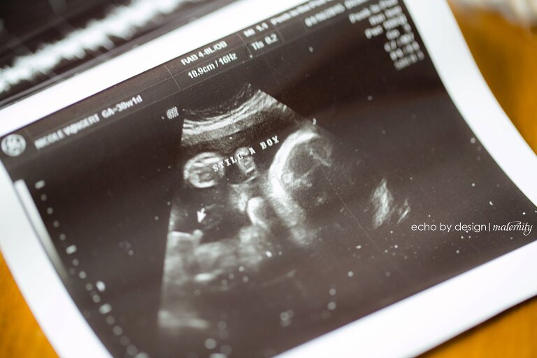 Dayton_Newborn_Photographer_Wingert_Maternity10